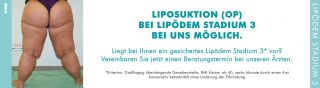 spezialisten fur bakterielle erkrankungen dusseldorf MVZ Praxis Dr. Cornely - Hautarzt in Düsseldorf